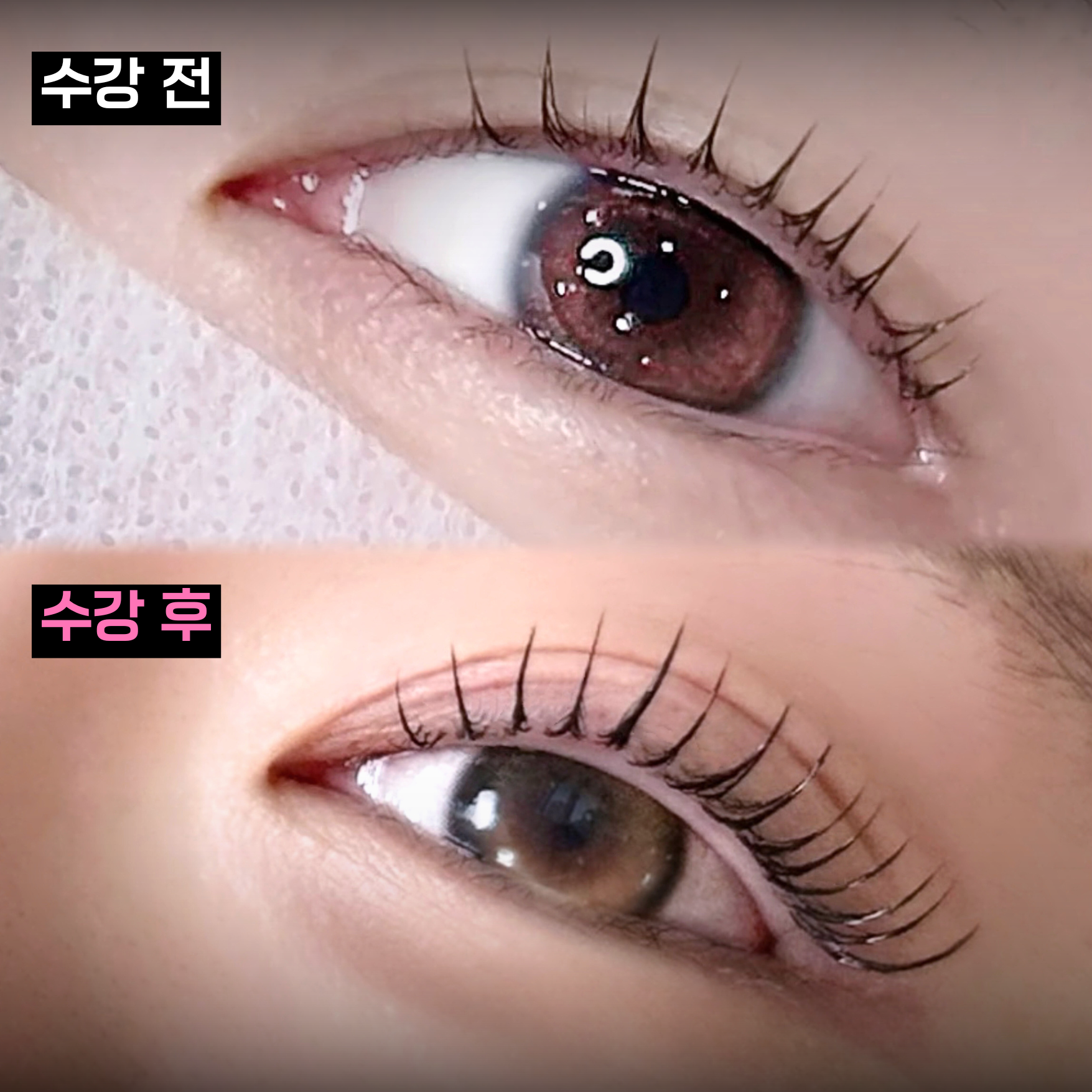 수강생 Before & After 4